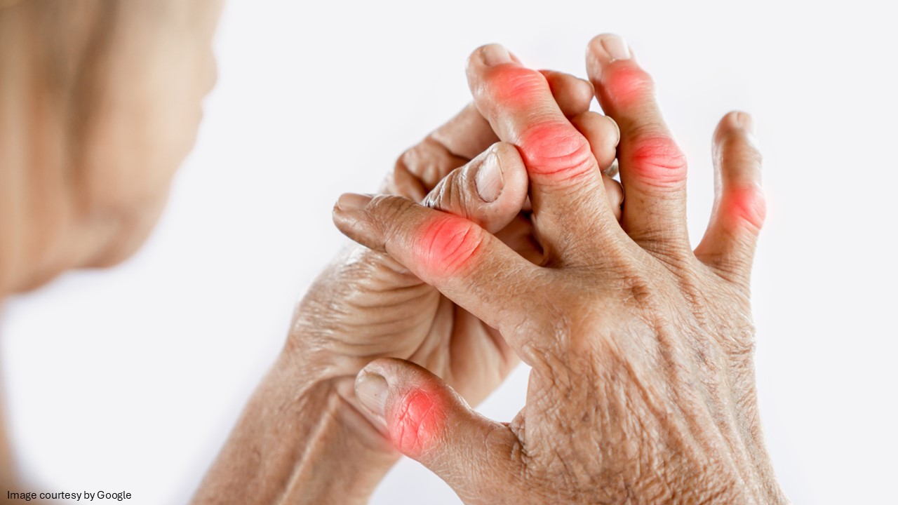 how to prevent arthritis - All Day Chemist