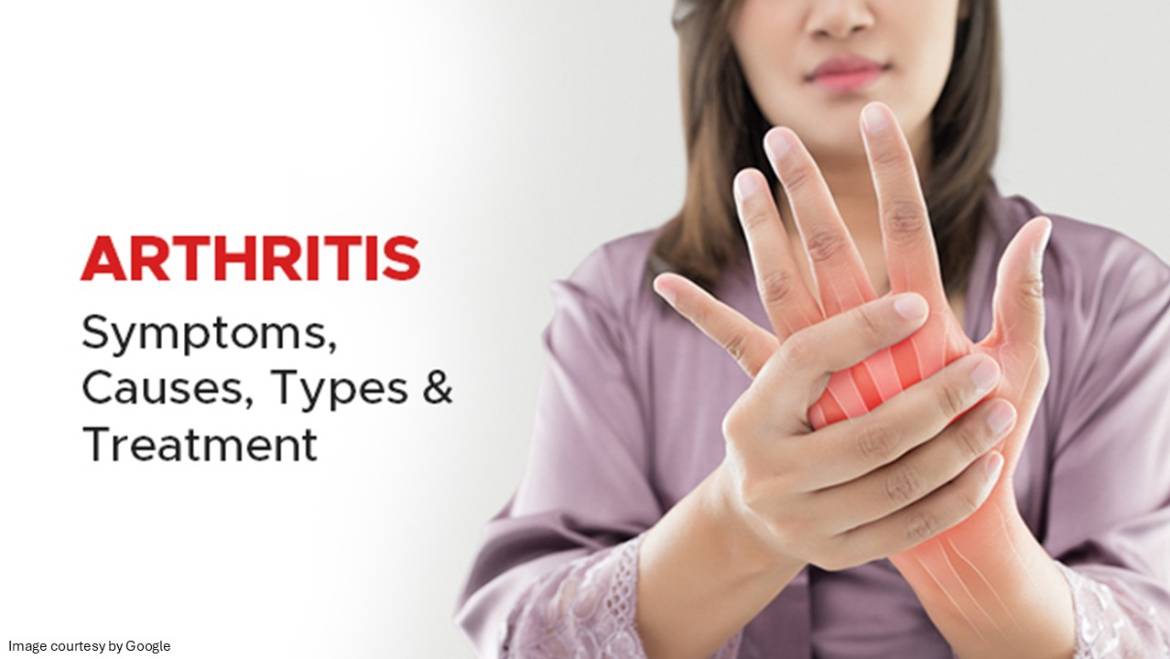 Preventive Measures for Arthritis Relief