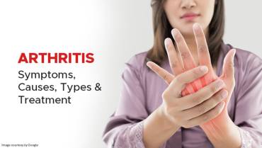 Preventive Measures for Arthritis Relief