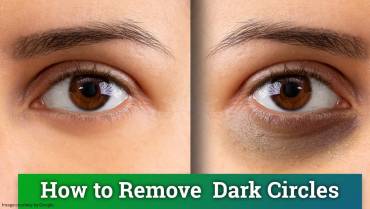 How to reduce dark circles?