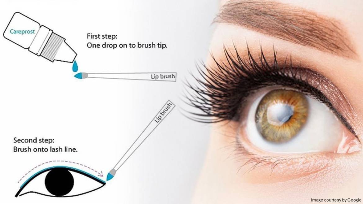 Enhance Eyelashes with Careprost Eye Drops