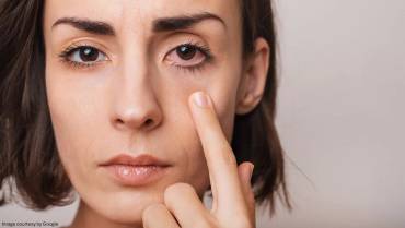 Few Effective Home Remedies For Chalazion