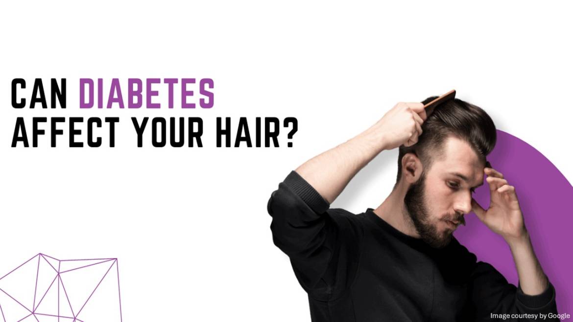 Can Diabetes Affect Your Hair Growth?