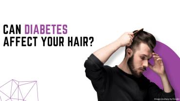 Can Diabetes Affect Your Hair Growth?