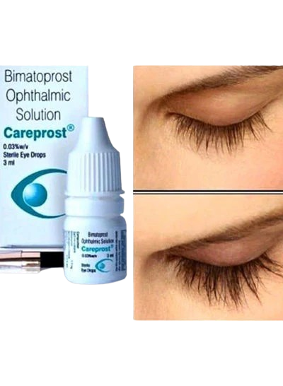 careprost eye drops for eyelashes