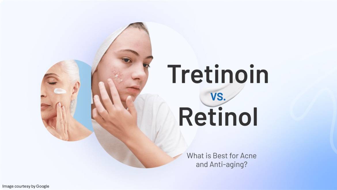 Retinol vs Tretinoin: which anti-aging ingredient is best for you?