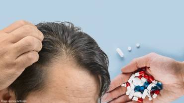 Finasteride for Hair Loss: How It Works and What to Expect