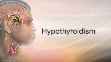 Hypothyroidism & Mental Health: The Surprising Connection